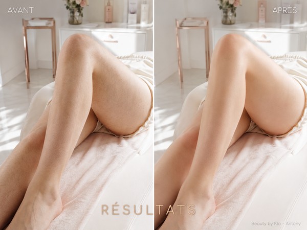 Résultat soin corps - avant après modelage maderothérapie - Beauty by Klo Antony